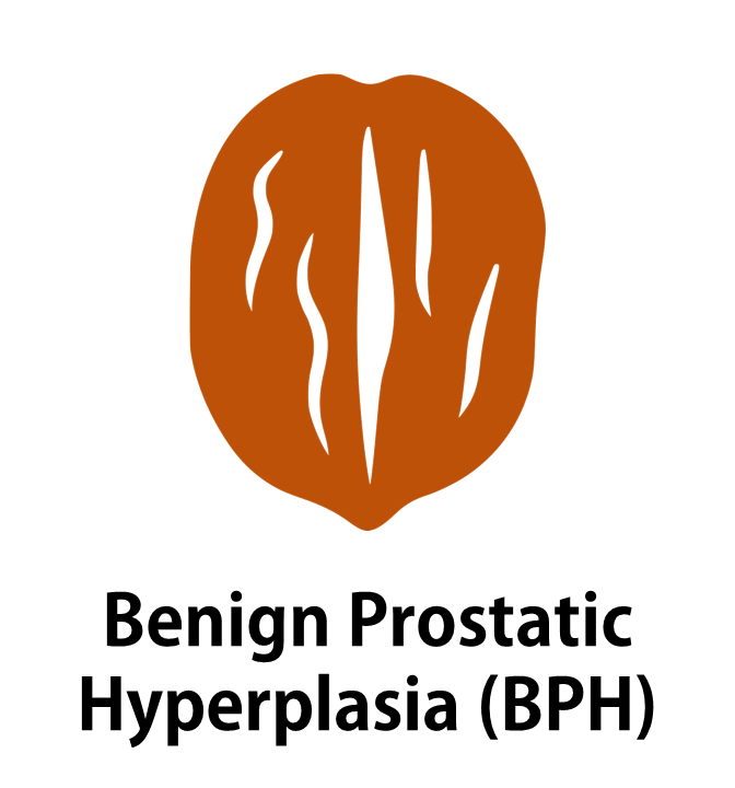 Benign prostatic hyperplasia (BPH)